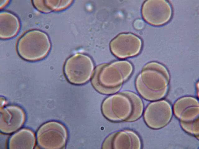 Sangre en microscopio
